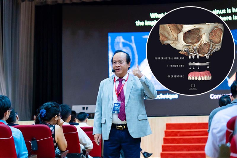 Implant cá nhân hoá, cơ hội cho những bệnh nhân không răng bẩm sinh