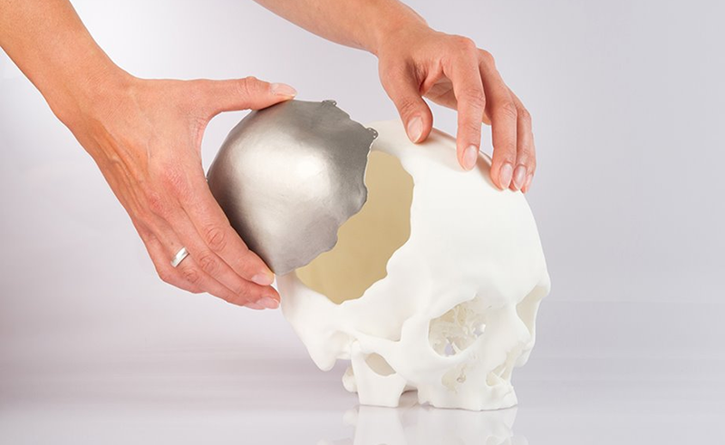 Ứng dụng in 3D trong lĩnh vực y tế, tiềm năng và thách thức