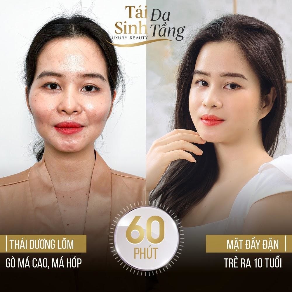 Trẻ lại 10 tuổi chỉ trong 60 phút cùng Tái Sinh Đa Tầng