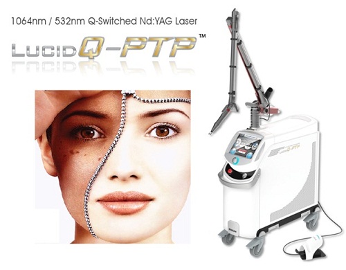 Trải nghiệm trị nám bằng máy Laser Lucid Q-PTP tại Clvoer Spa chỉ với 700 ngàn