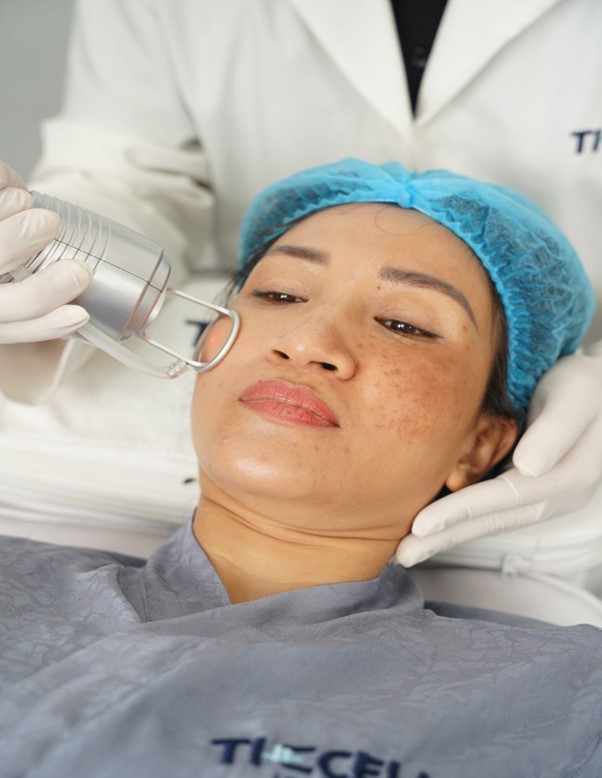 Max Cell tác động tận sâu bên trong hạ bì, xử lý triệt để các hắc tố melanin