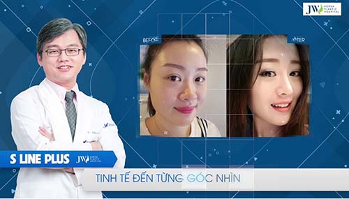 TS.BS Man Koon Suh đã từng thực hiện thành công nhiều ca mũi khó