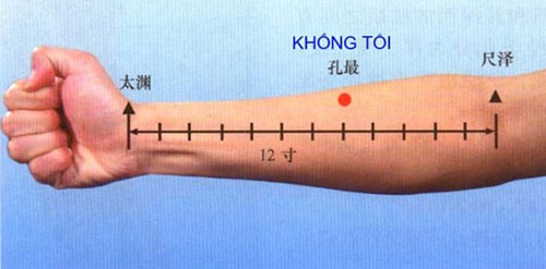 Bệnh trĩ không nguy hiểm nhưng lại gây nhiều phiền toái cho bệnh nhân. Huyệt không tối