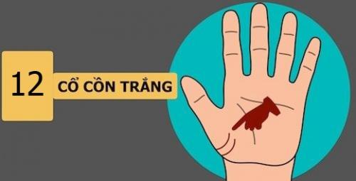 đường cổ cồn trắng