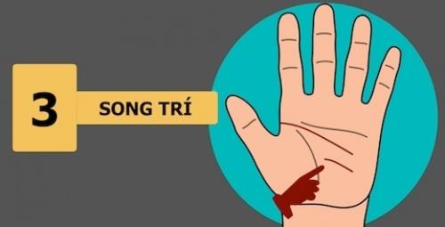 đường song trí