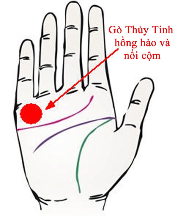 Gò Thủy Tinh hồng hào và nổi cộm