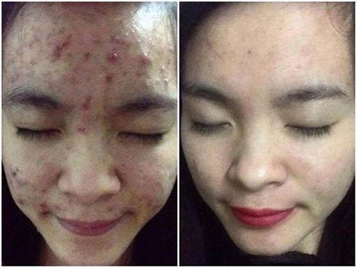 trang-da-blogtamsuvn4
