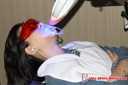 Tẩy trắng tăng bằng công nghệ đèn zoom hiện đại