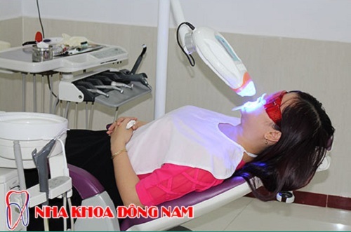Tẩy trắng tăng bằng công nghệ đèn zoom hiện đại