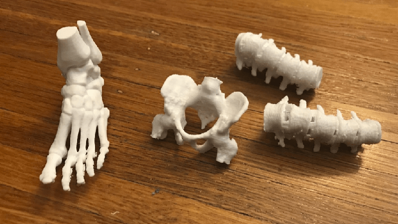 Một số bộ phận cơ thể người được tạo ra bằng công nghệ in 3D