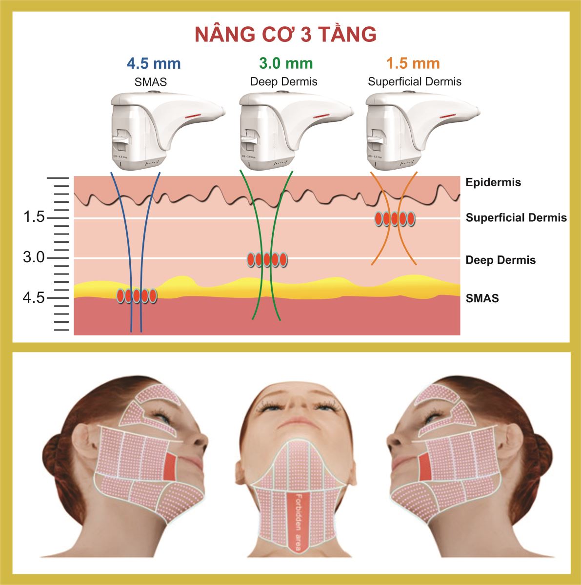 Với kỹ thuật điều trị đa tầng, công nghệ trẻ hóa da HIFU ULTRAFORMER III giúp hiệu quả điều trị nhanh chóng và duy trì kết quả lâu dài